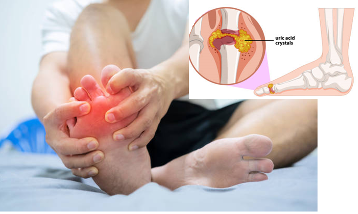 Những loại bệnh không nên uống collagen?